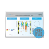 GET FREE DESIGN | KAIZEN PDCA CYCLE PROCESS Tracking Whiteboard | Dry-Erase Magnetic Industrial-Grade